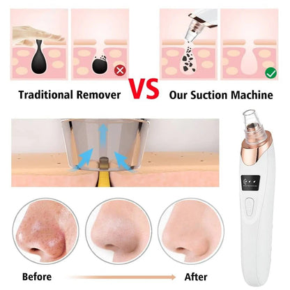 Electric Blackhead Remover Vacuum Pore Cleaner for Acne & Deep Cleansing