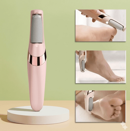 Powerful Callus Remover for Cracked Heels & Dead Skin